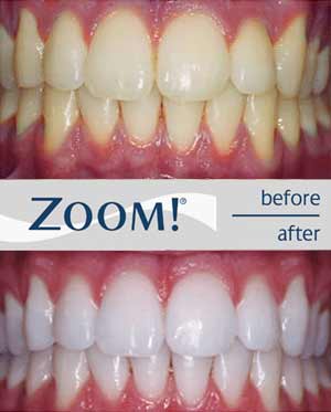Dr. Joseph S. Levy: Excellence in Dentistry